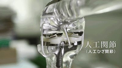 陶瓷骨頭關(guān)節(jié).gif 陶瓷人造骨關(guān)節(jié)動圖.gif